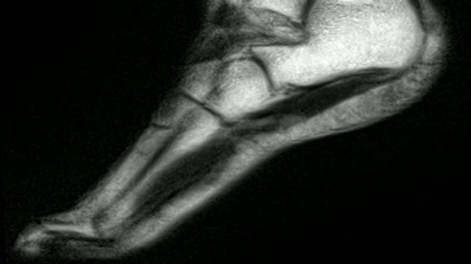 30T_SA_20240212_ANKLE_039Y_17_[t2_haste_sag_moving]_[SBA24SH30A]